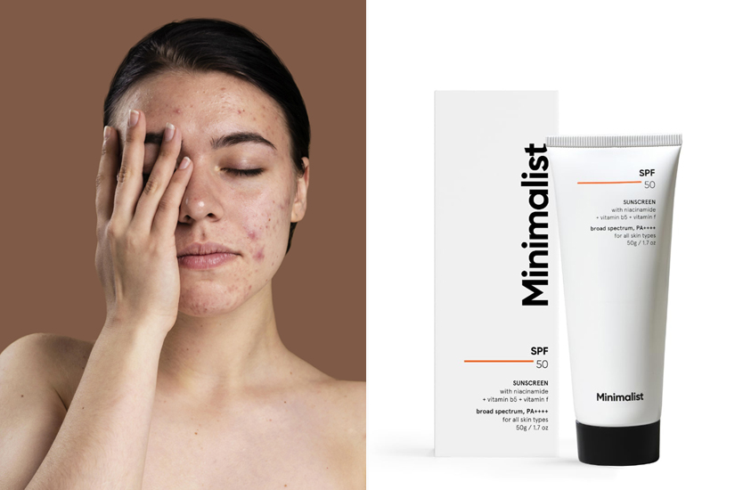 Sensitive Skin Sunscreen