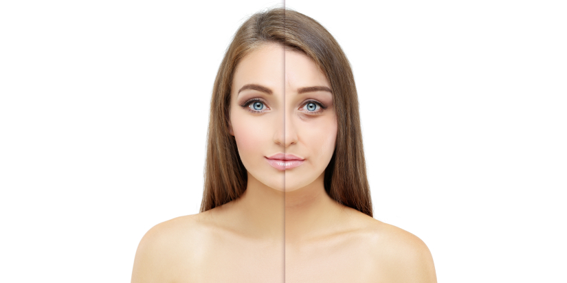 What is Facial Asymmetry and Why is Everyone Talking About It_