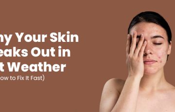 Skin Breakouts in Summer