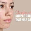 Daily routine for Acne-Prone Skin
