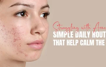 Daily routine for Acne-Prone Skin